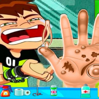 Ben10 Hand Doctor - Free Online Game